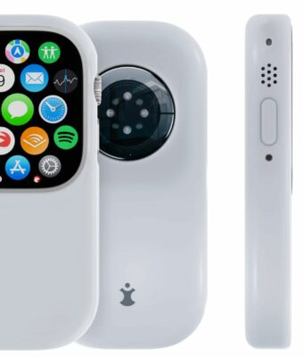 TinyPod promění vaše Apple Watch v iPod
