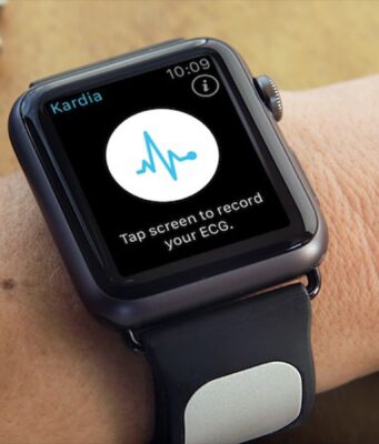 Apple vyhrál dlouhodobý spor se společností AliveCor, která se specializuje na sledování srdeční činnosti